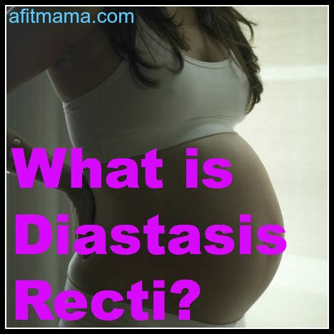 What is Diastasis Recti? How do you Heal Diastasis Recti?